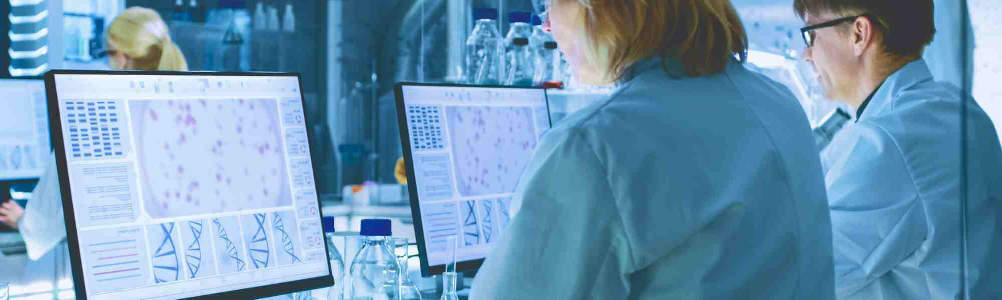 Distribution: Inventory Optimization